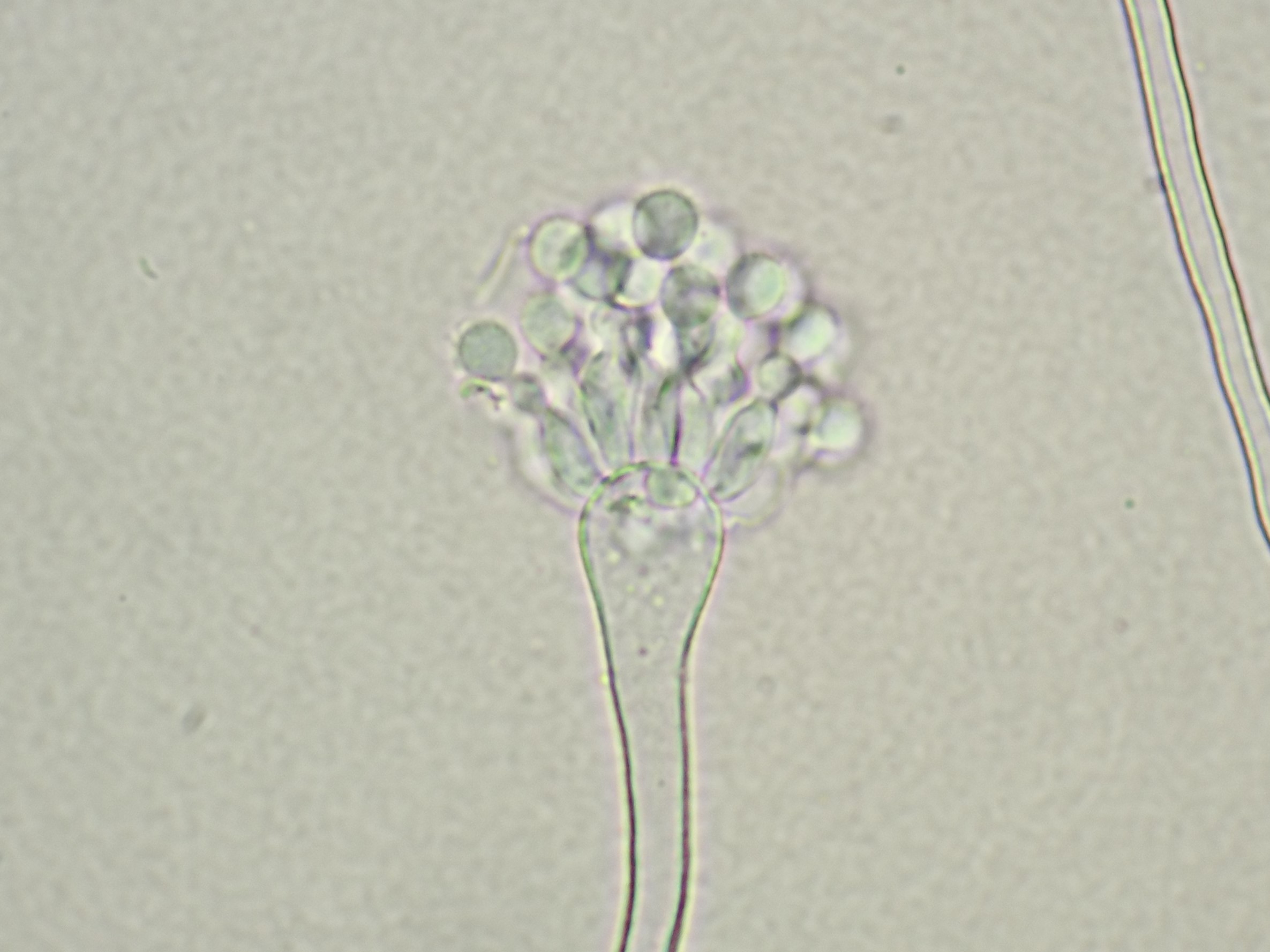 顕微鏡で見たコウジカビ（Aspergillus oryzae)の姿。球形の胞子（分生子）と、とっくり形の胞子を作る細胞が観察できます。