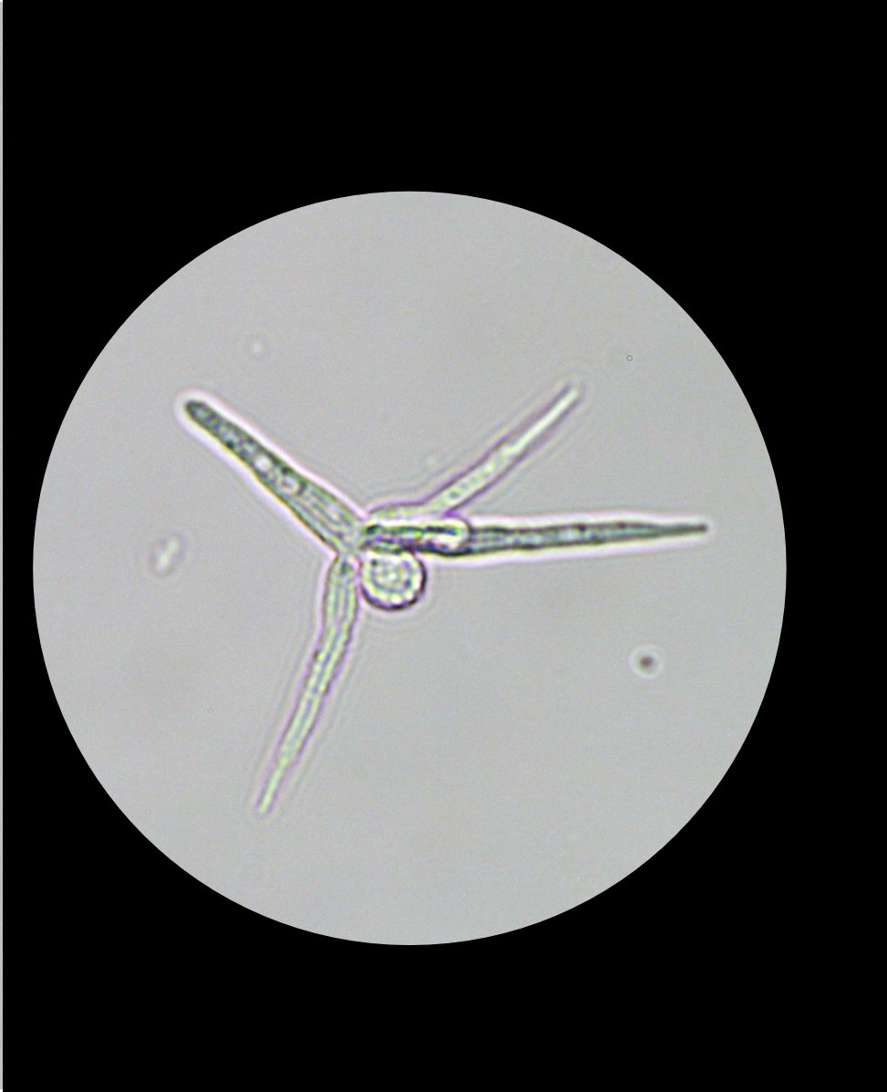 川の水にみられるカビの胞子